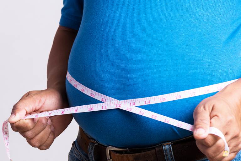 obesity